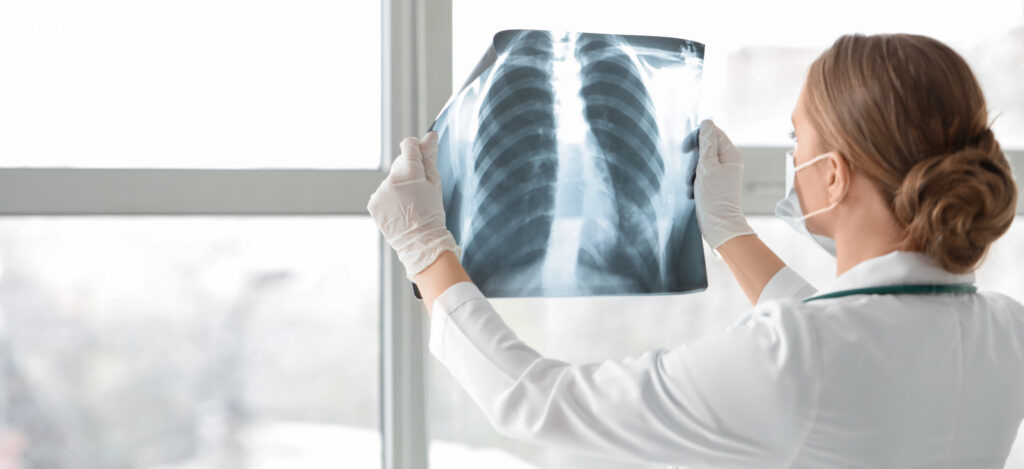 Female doctor with x-ray image of lungs in clinic